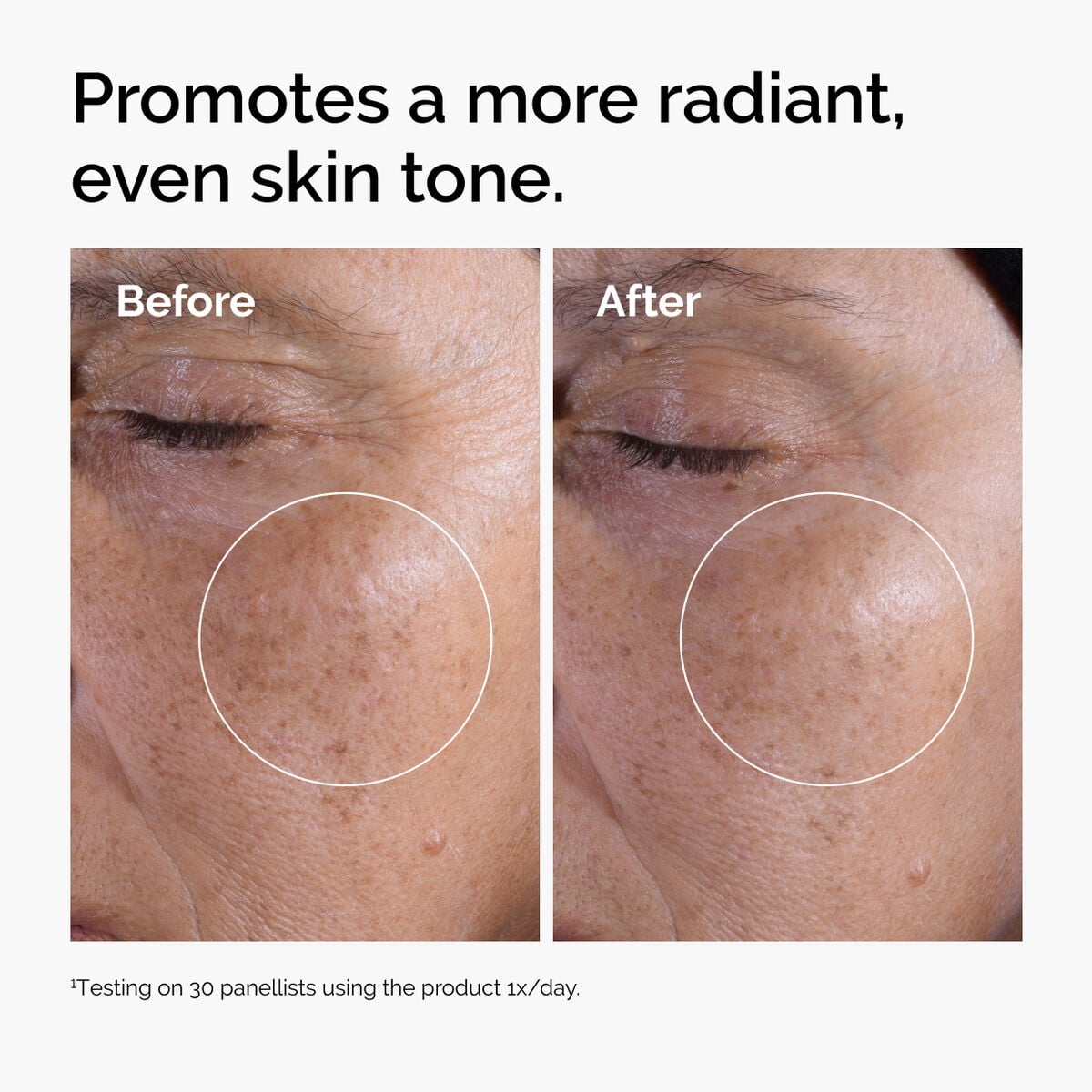 glycolic-acid-7-exfoliating-toner-n4 ord-glycolic-before-after-radiance.jpg
