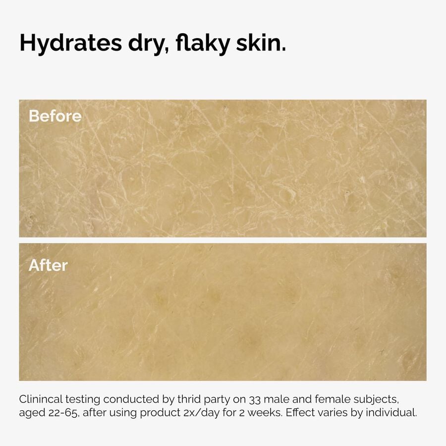 the-body-care-collection-h2 ord-natural-moisturizing-factors-inulin-body-before-after-graphic-02.jpg