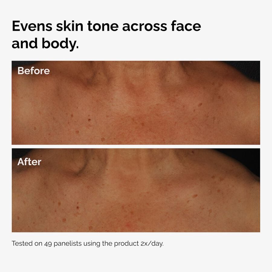 the-body-care-collection-h2 ord-niacinamide-face-body-serum-before-after-even-tone-graphic.jpg