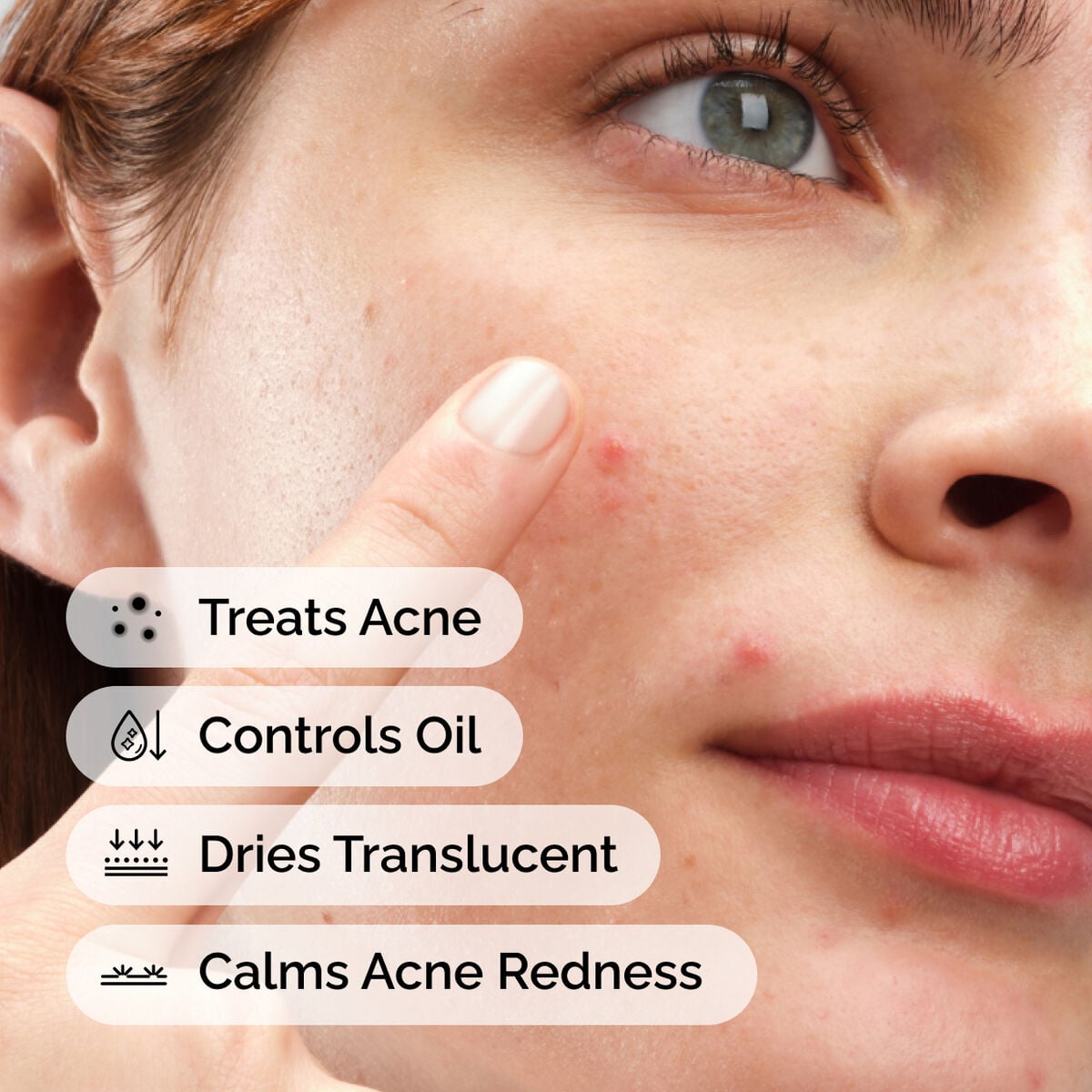 sulfur-10-powder-to-cream-concentrate-w7 ord-sulfur-10pct-powder-to-cream-concentrate-model-application-with-benefits-acne.jpg